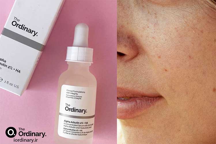 قیمت سرم آلفا آربوتین اوردینری