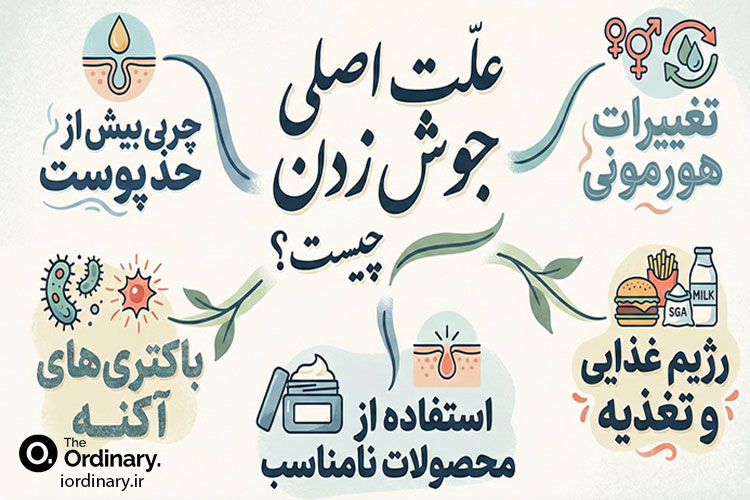 علت اصلی جوش زدن چیست؟