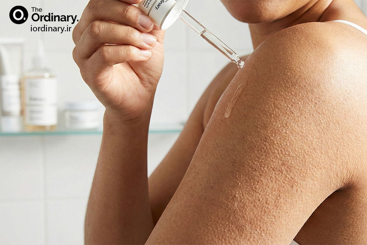 پوست مرغی چیست و روش های درمان آن