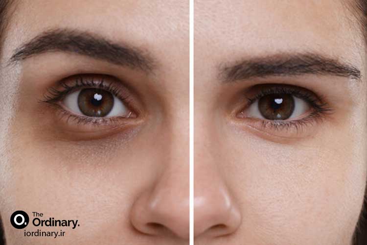 قیمت محصولات دورچشم اوردینری اصل