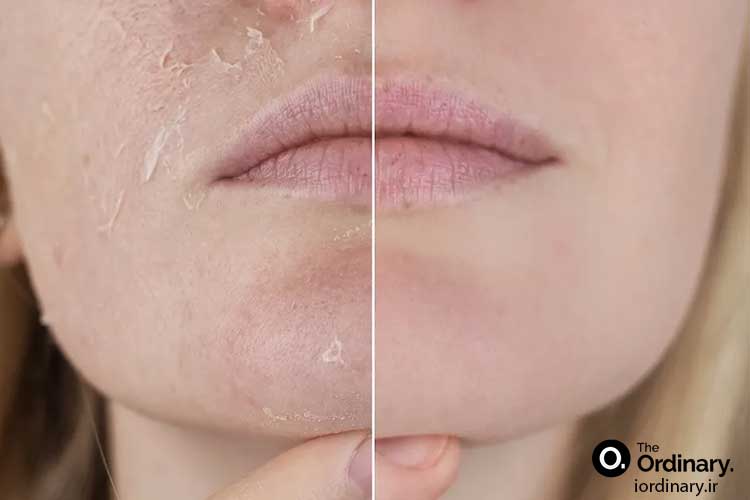 قیمت محصولات آبرسان و مرطوب کننده اوردینری اصل