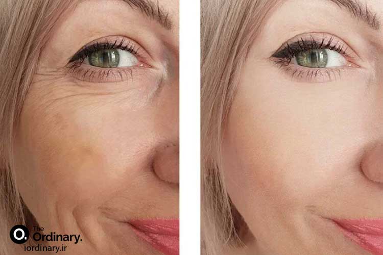 راهنمای جامع خرید سرم های ضد چروک و لیفتینگ اوردینری اصل