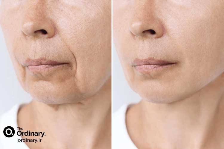 قیمت محصولات ضد چروک و لیفتینگ اوردینری اصل