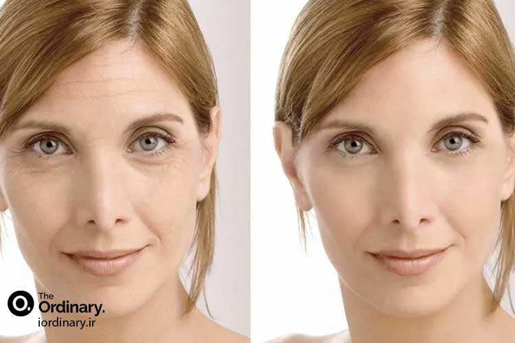 خرید اینترنتی سرم های ضد چروک و لیفتینگ اوردینری