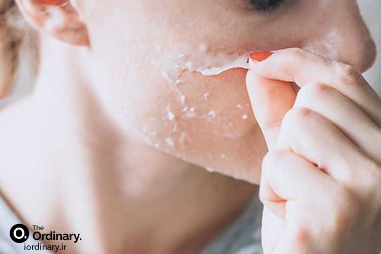 معرفی محصولات لایه بردار اوردینری