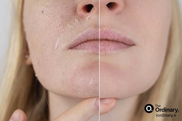 خرید اینترنتی لایه بردارهای اوردینری